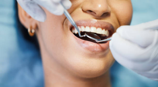 Best Urgent Tooth Repair  in North Madison, OH