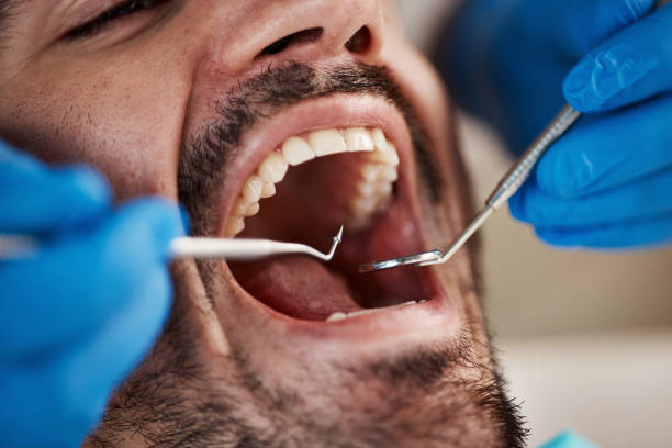 Best Dentist for Tooth Abscess  in North Madison, OH