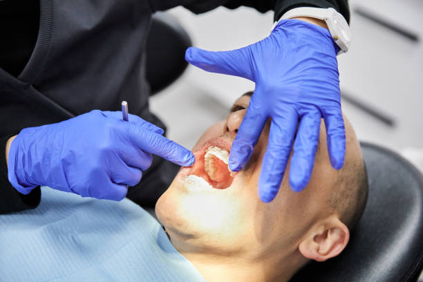 Best Emergency Gum Pain Relief  in North Madison, OH