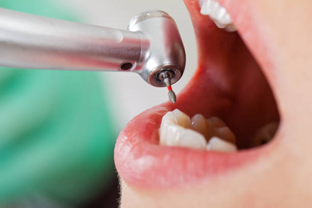 Best Urgent Tooth Repair  in North Madison, OH